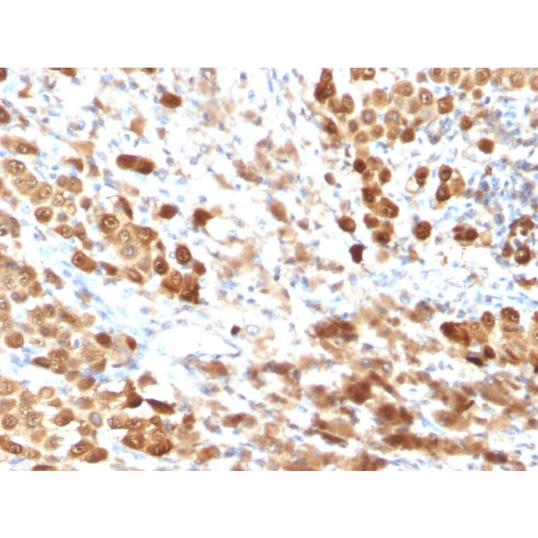 Immunohistochemistry - Anti-S100 beta Antibody [SPM354] (A249934) - Antibodies.com