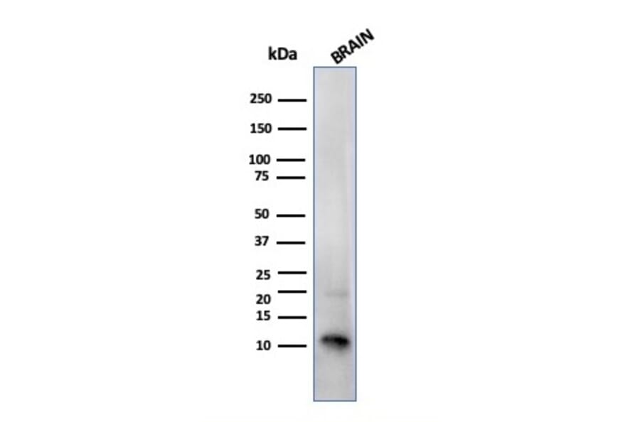 Western Blot - Anti-S100 beta Antibody [SPM354] (A249935) - Antibodies.com