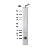 Western Blot - Anti-S100 beta Antibody [SPM354] (A249935) - Antibodies.com
