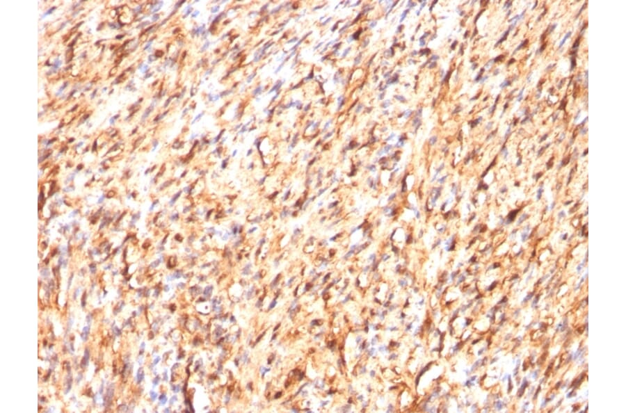 Immunohistochemistry - Anti-S100 beta Antibody [S100B/1012] (A249936) - Antibodies.com