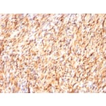 Immunohistochemistry - Anti-S100 beta Antibody [S100B/1012] (A249936) - Antibodies.com