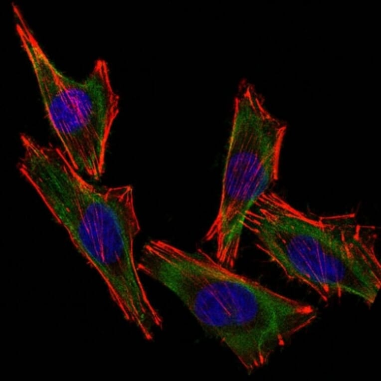 Immunofluorescence - Anti-S100 beta Antibody [S100B/1012] (A249936) - Antibodies.com
