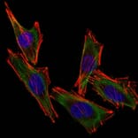 Immunofluorescence - Anti-S100 beta Antibody [S100B/1012] (A249936) - Antibodies.com
