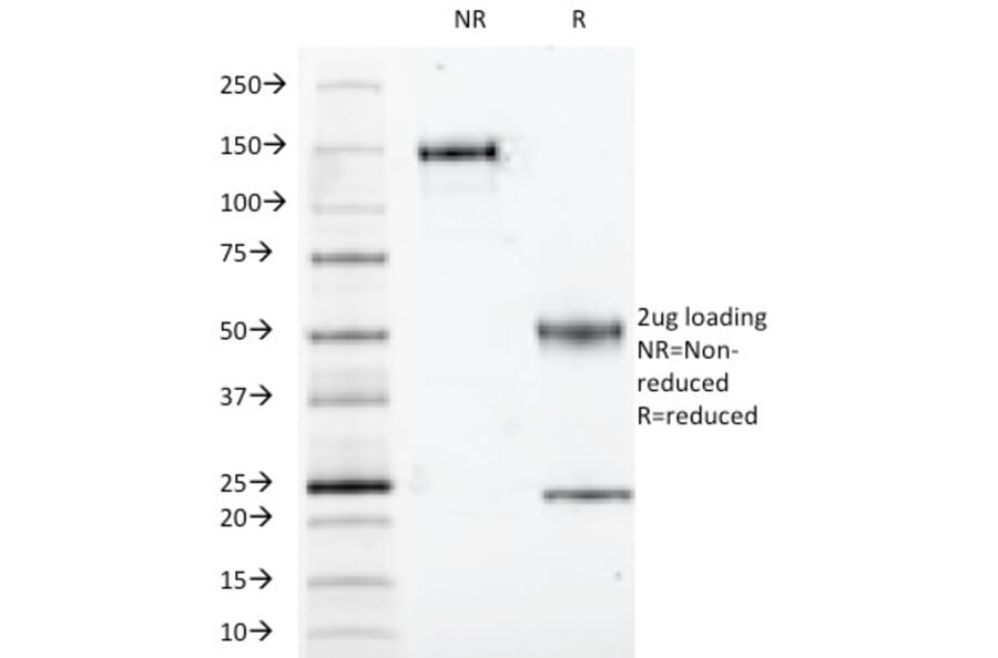 SDS-PAGE - Anti-S100 beta Antibody [S100B/1012] (A249936) - Antibodies.com