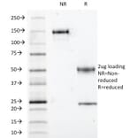 SDS-PAGE - Anti-S100 beta Antibody [S100B/1012] (A249936) - Antibodies.com