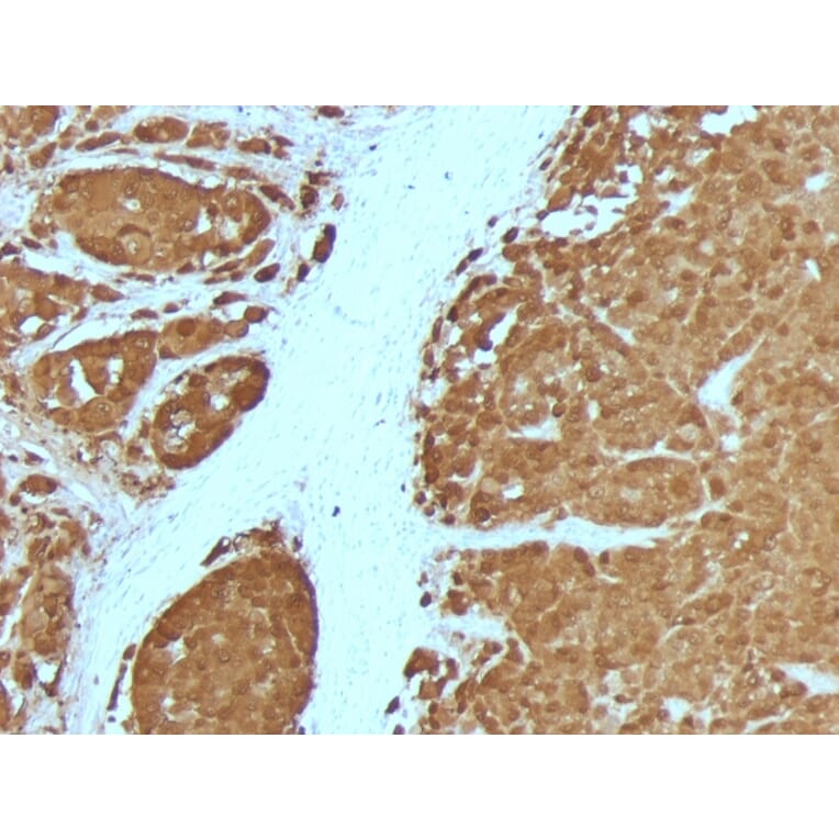 Immunohistochemistry - Anti-S100 beta Antibody [4C4.9 + S100B/1012] (A249937) - Antibodies.com