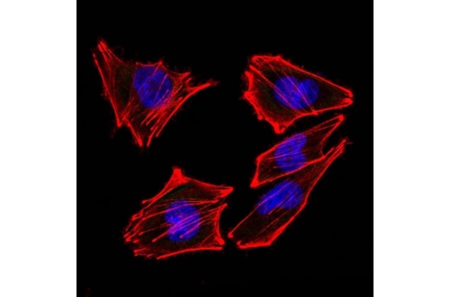 Immunofluorescence - Anti-S100 beta Antibody [4C4.9 + S100B/1012] (A249937) - Antibodies.com