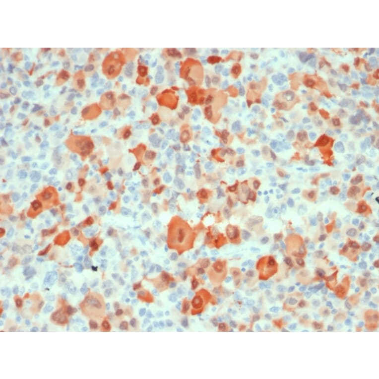 Immunohistochemistry - Anti-S100 beta Antibody [rS100B/1896] (A249938) - Antibodies.com