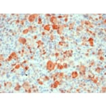 Immunohistochemistry - Anti-S100 beta Antibody [rS100B/1896] (A249938) - Antibodies.com