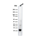 Western Blot - Anti-S100 beta Antibody [rS100B/1896] (A249938) - Antibodies.com
