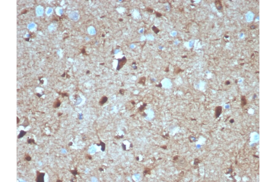 Immunohistochemistry - Anti-S100 beta Antibody [S100B/4139] (A249939) - Antibodies.com