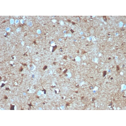 Immunohistochemistry - Anti-S100 beta Antibody [S100B/4139] (A249939) - Antibodies.com