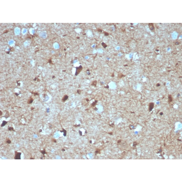 Immunohistochemistry - Anti-S100 beta Antibody [S100B/4139] (A249939) - Antibodies.com