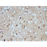 Immunohistochemistry - Anti-S100 beta Antibody [S100B/4139] (A249939) - Antibodies.com