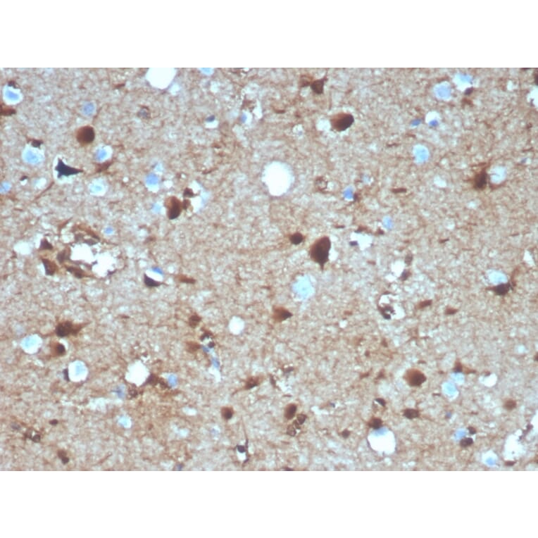 Immunohistochemistry - Anti-S100 beta Antibody [S100B/4139] (A249939) - Antibodies.com