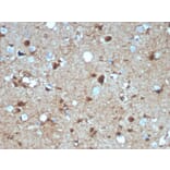 Immunohistochemistry - Anti-S100 beta Antibody [S100B/4139] (A249939) - Antibodies.com
