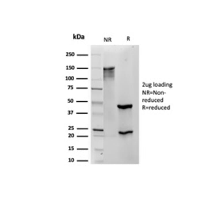 SDS-PAGE - Anti-S100 beta Antibody [S100B/4139] (A249939) - Antibodies.com
