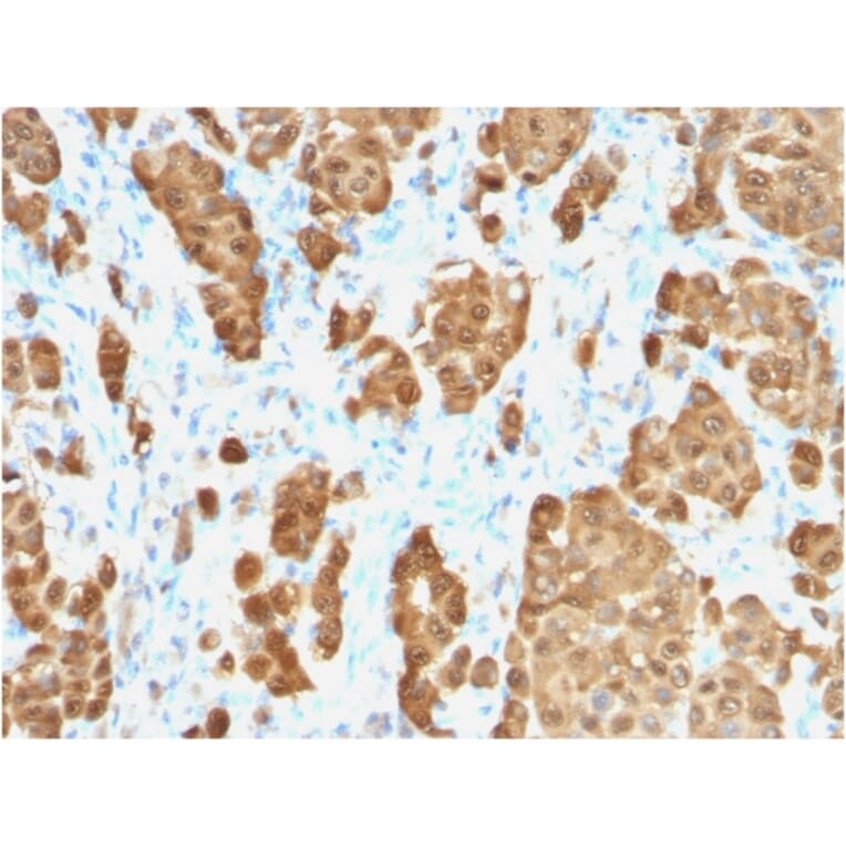 Immunohistochemistry - Anti-S100 beta Antibody [S100B/1706R] (A249940) - Antibodies.com