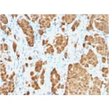 Immunohistochemistry - Anti-S100 beta Antibody [S100B/1706R] (A249940) - Antibodies.com