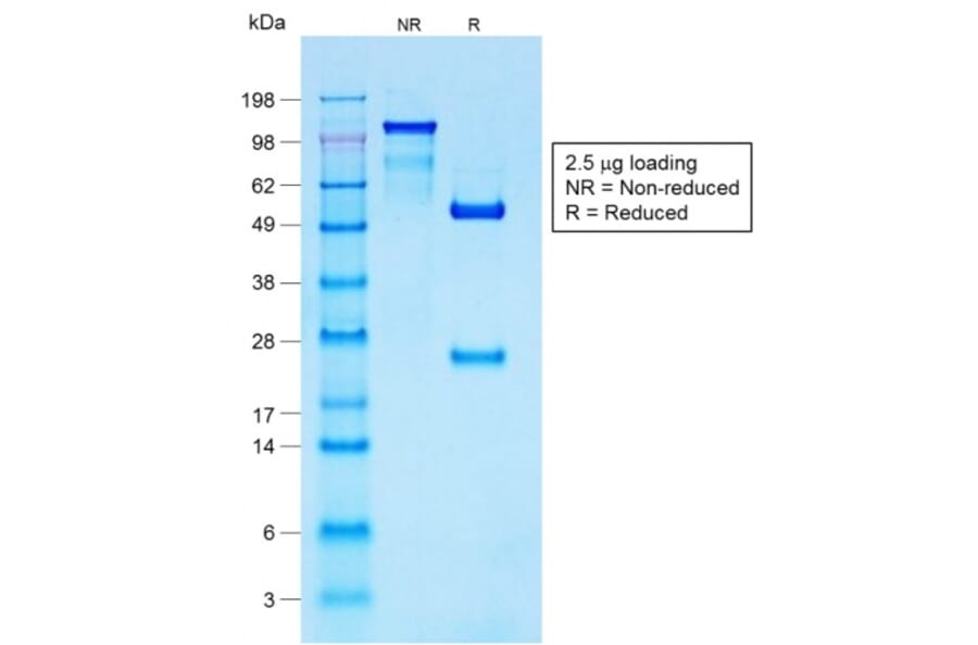 SDS-PAGE - Anti-S100 beta Antibody [S100B/1706R] (A249940) - Antibodies.com