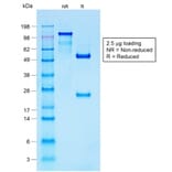 SDS-PAGE - Anti-S100 beta Antibody [S100B/1706R] (A249940) - Antibodies.com