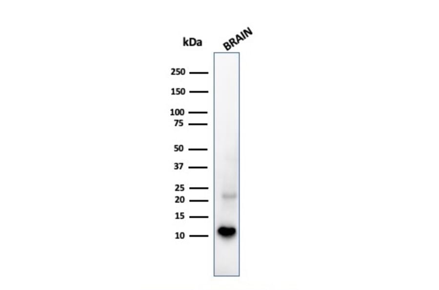 Western Blot - Anti-S100 beta Antibody [S100B/1706R] (A249940) - Antibodies.com