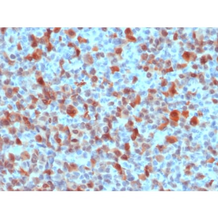 Immunohistochemistry - Anti-S100 beta Antibody (A249940) - Antibodies.com