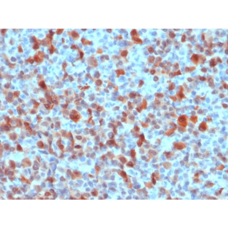 Immunohistochemistry - Anti-S100 beta Antibody (A249940) - Antibodies.com