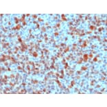 Immunohistochemistry - Anti-S100 beta Antibody (A249940) - Antibodies.com