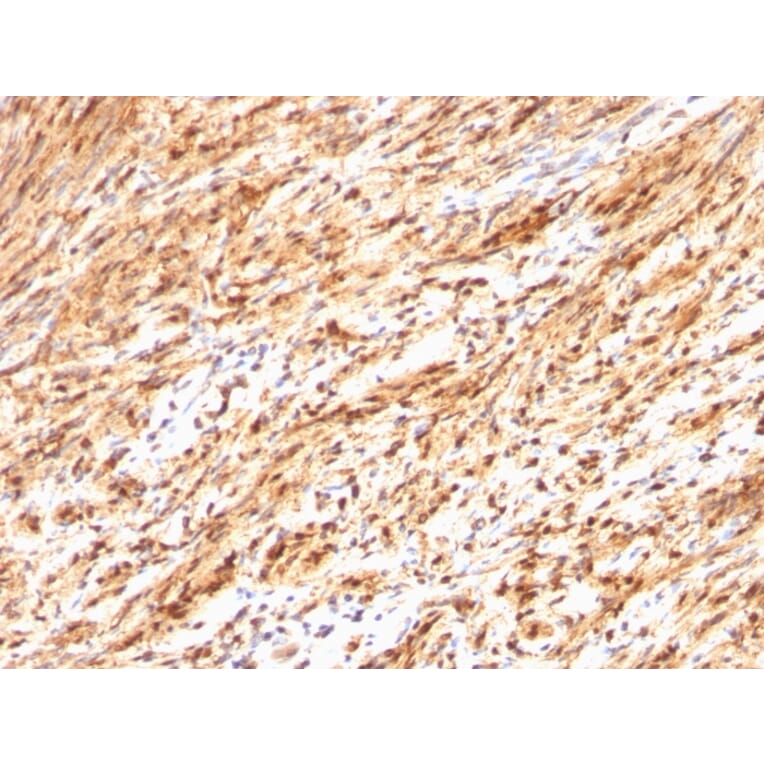 Immunohistochemistry - Anti-S100 beta Antibody (A249941) - Antibodies.com