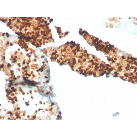 Immunohistochemistry - Anti-S100P Antibody [S100P/4386R] (A249941) - Antibodies.com
