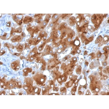 Immunohistochemistry - Anti-Serum Amyloid A Antibody [SAA/326] (A249943) - Antibodies.com