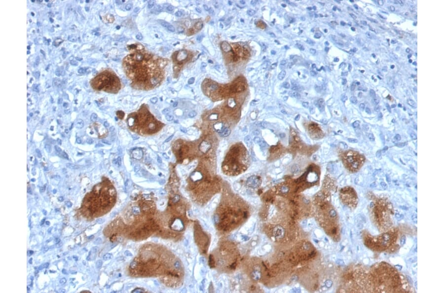 Immunohistochemistry - Anti-Serum Amyloid A Antibody [SAA/326] (A249942) - Antibodies.com
