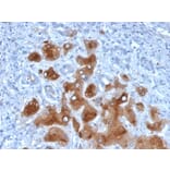 Immunohistochemistry - Anti-Serum Amyloid A Antibody [SAA/326] (A249942) - Antibodies.com