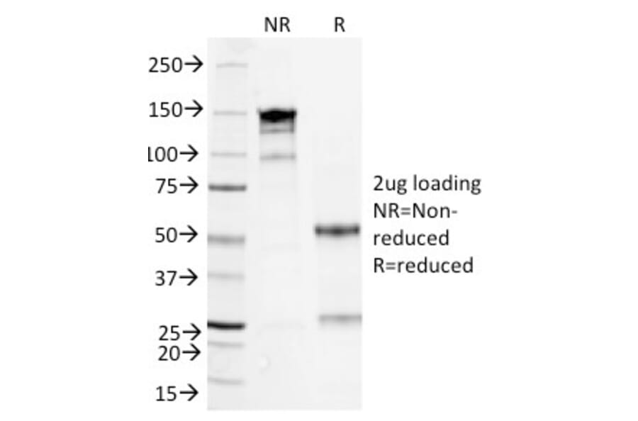 SDS-PAGE - Anti-Serum Amyloid A Antibody [SAA/326] (A249943) - Antibodies.com