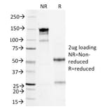 SDS-PAGE - Anti-Serum Amyloid A Antibody [SAA/326] (A249943) - Antibodies.com