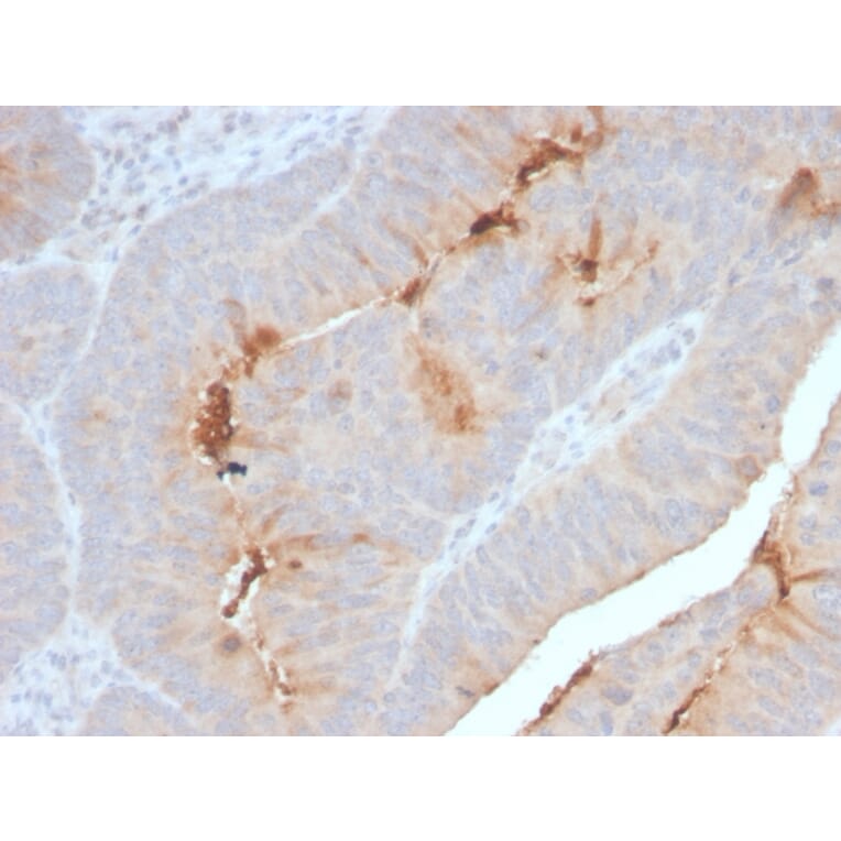 Immunohistochemistry - Anti-Serum Amyloid A Antibody [SAA/2868R] (A249943) - Antibodies.com