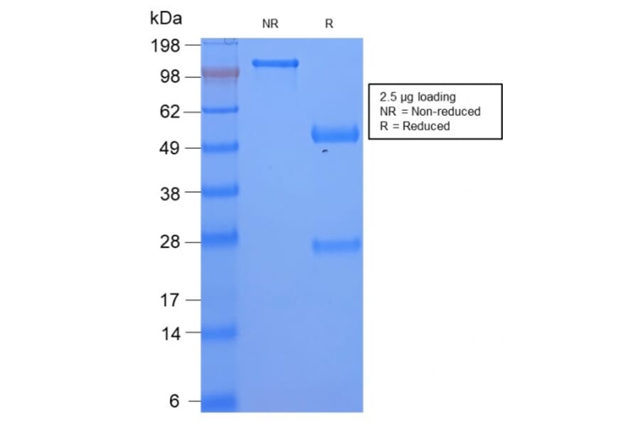SDS-PAGE - Anti-Serum Amyloid A Antibody [SAA/2868R] (A249944) - Antibodies.com