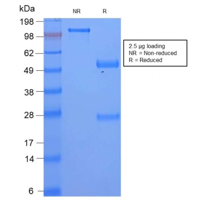 SDS-PAGE - Anti-Serum Amyloid A Antibody [SAA/2868R] (A249944) - Antibodies.com