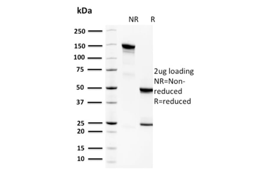SDS-PAGE - Anti-Spermidine Antibody [CPTC-SAT1-3] (A249945) - Antibodies.com
