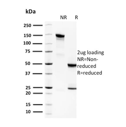 SDS-PAGE - Anti-Spermidine Antibody [CPTC-SAT1-3] (A249945) - Antibodies.com