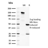 SDS-PAGE - Anti-Spermidine Antibody [CPTC-SAT1-3] (A249945) - Antibodies.com