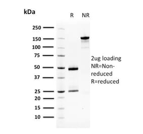 SDS-PAGE - Anti-Squamous Cell Carcinoma Antigen 1 Antibody [CPTC-SERPINB3-2] (A249946) - Antibodies.com