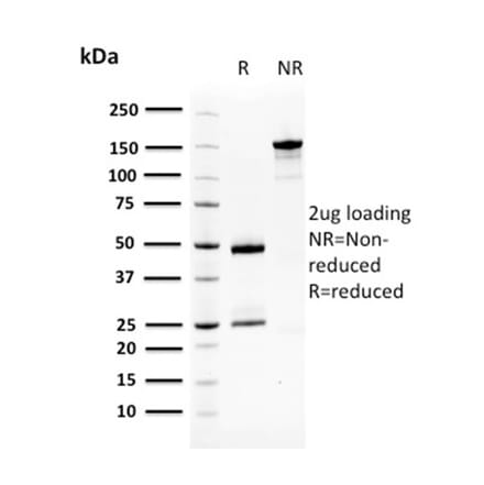 SDS-PAGE - Anti-Squamous Cell Carcinoma Antigen 1 Antibody [CPTC-SERPINB3-2] (A249946) - Antibodies.com