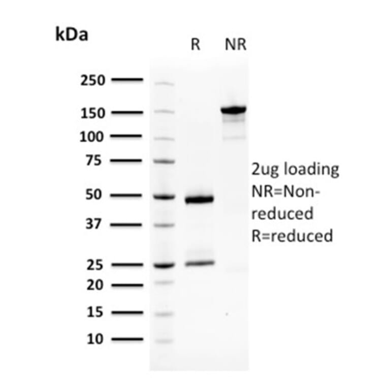 SDS-PAGE - Anti-Squamous Cell Carcinoma Antigen 1 Antibody [CPTC-SERPINB3-2] (A249946) - Antibodies.com