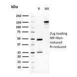 SDS-PAGE - Anti-Squamous Cell Carcinoma Antigen 1 Antibody [CPTC-SERPINB3-2] (A249946) - Antibodies.com