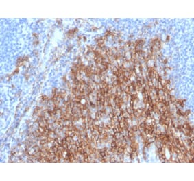Immunohistochemistry - Anti-Syndecan 1 Antibody [SDC1/4378R] (A249947) - Antibodies.com