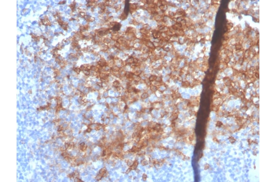 Immunohistochemistry - Anti-Syndecan 1 Antibody [SDC1/4378R] (A249946) - Antibodies.com