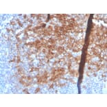 Immunohistochemistry - Anti-Syndecan 1 Antibody [SDC1/4378R] (A249946) - Antibodies.com