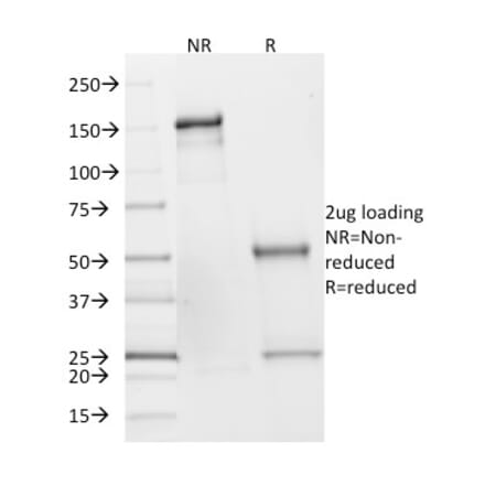 SDS-PAGE - Anti-SDHB Antibody [SDHB/2382] (A249948) - Antibodies.com